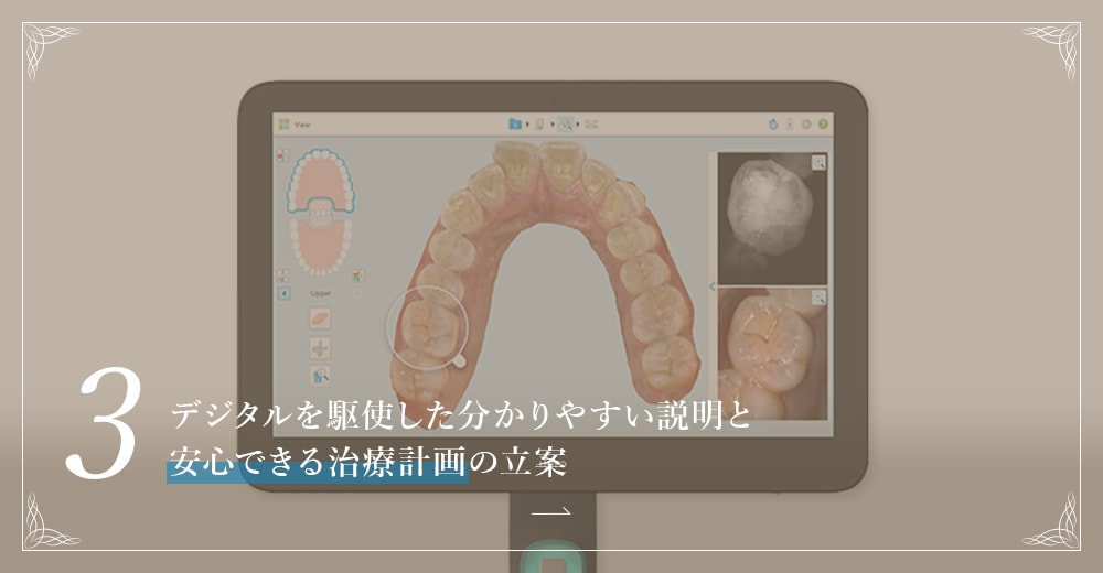 3.デジタルを駆使した分かりやすい説明と安心できる治療計画の立案