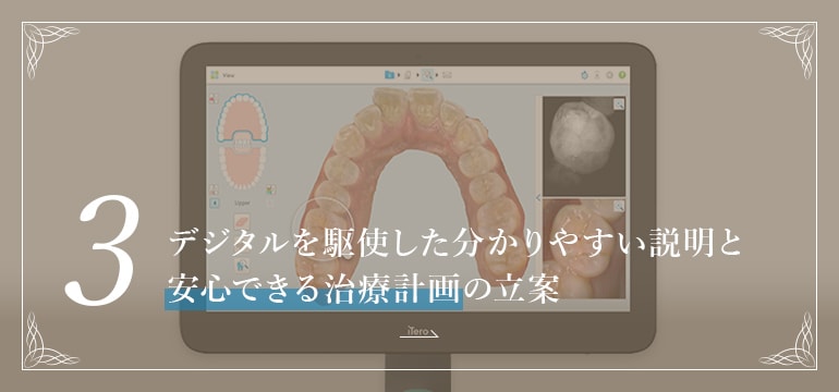 3.デジタルを駆使した分かりやすい説明と安心できる治療計画の立案